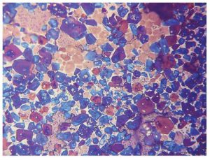 Figure 5: Clinker microscopy showing the various mineral phases (blue equals alite and brown is belite).